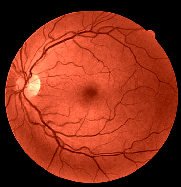Fig-1-Green-channel-of-the-fundus-image_colored_contrast.png